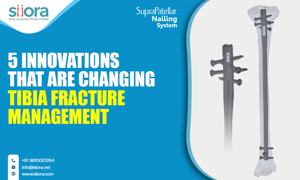 5 Innovations That Are Changing Tibia Fracture&nbsp;Management